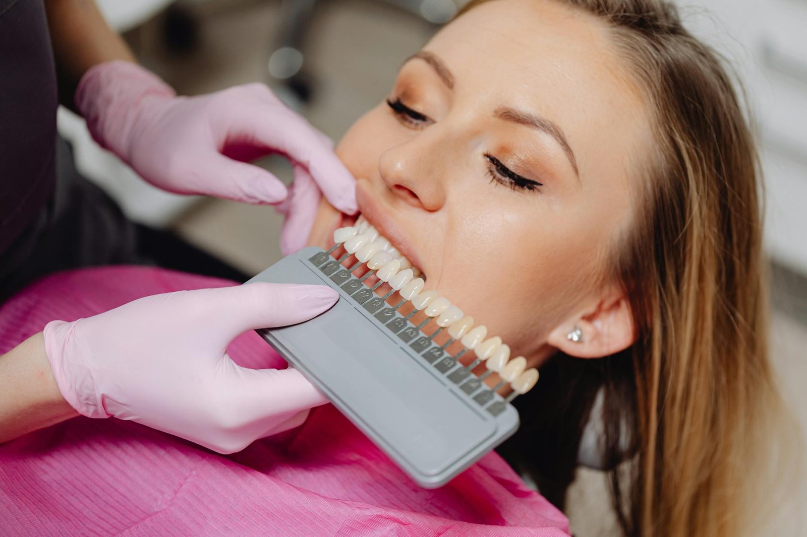 Illustration of Best Teeth Whitening Jubilee Hills: Must-Have Bright Smile Solutions