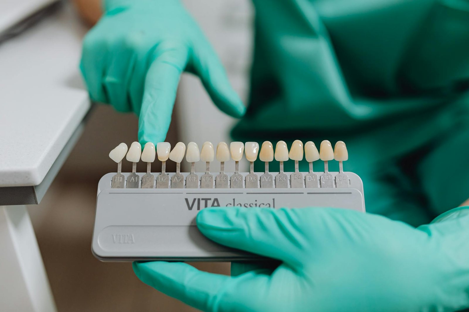 Illustration of Dental Veneers Guide: Must-Have Tips for Best Dentist Near Jubilee Hills
