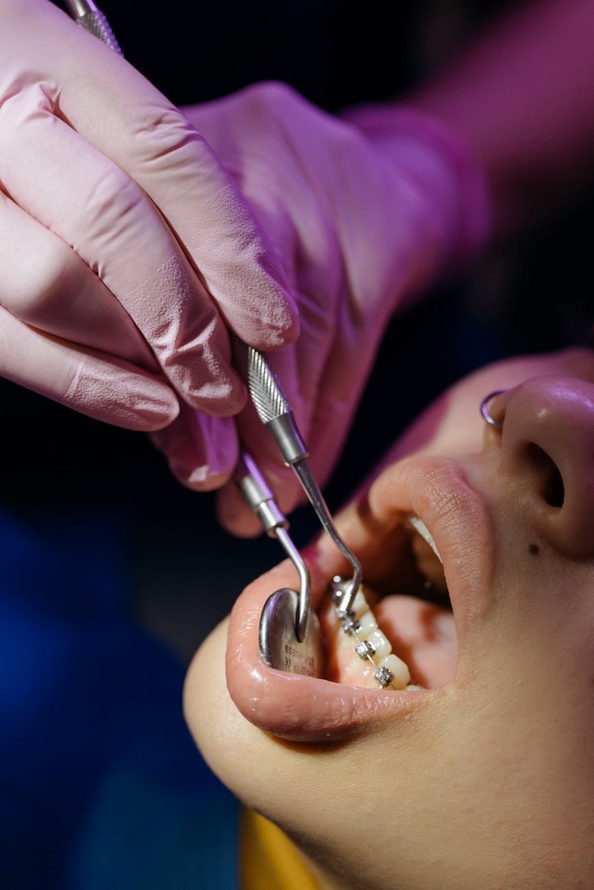 Illustration of Dentist ‘N’ Dontist Braces Treatment in Hyderabad – Best Experienced Team