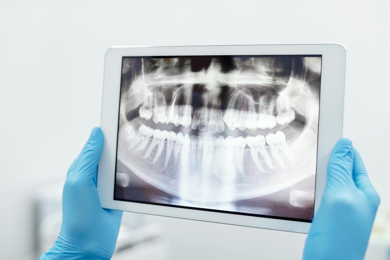 Illustration of Digital X Rays Benefits: Must-Have Affordable Dental Services Near Jubilee Hills