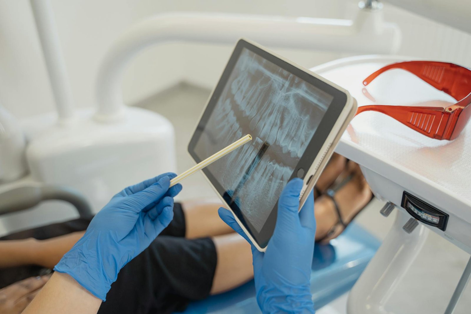 Illustration of Digital X‑Ray Hyderabad: Exclusive Benefits at Dentist N Dontist Jubilee Hills