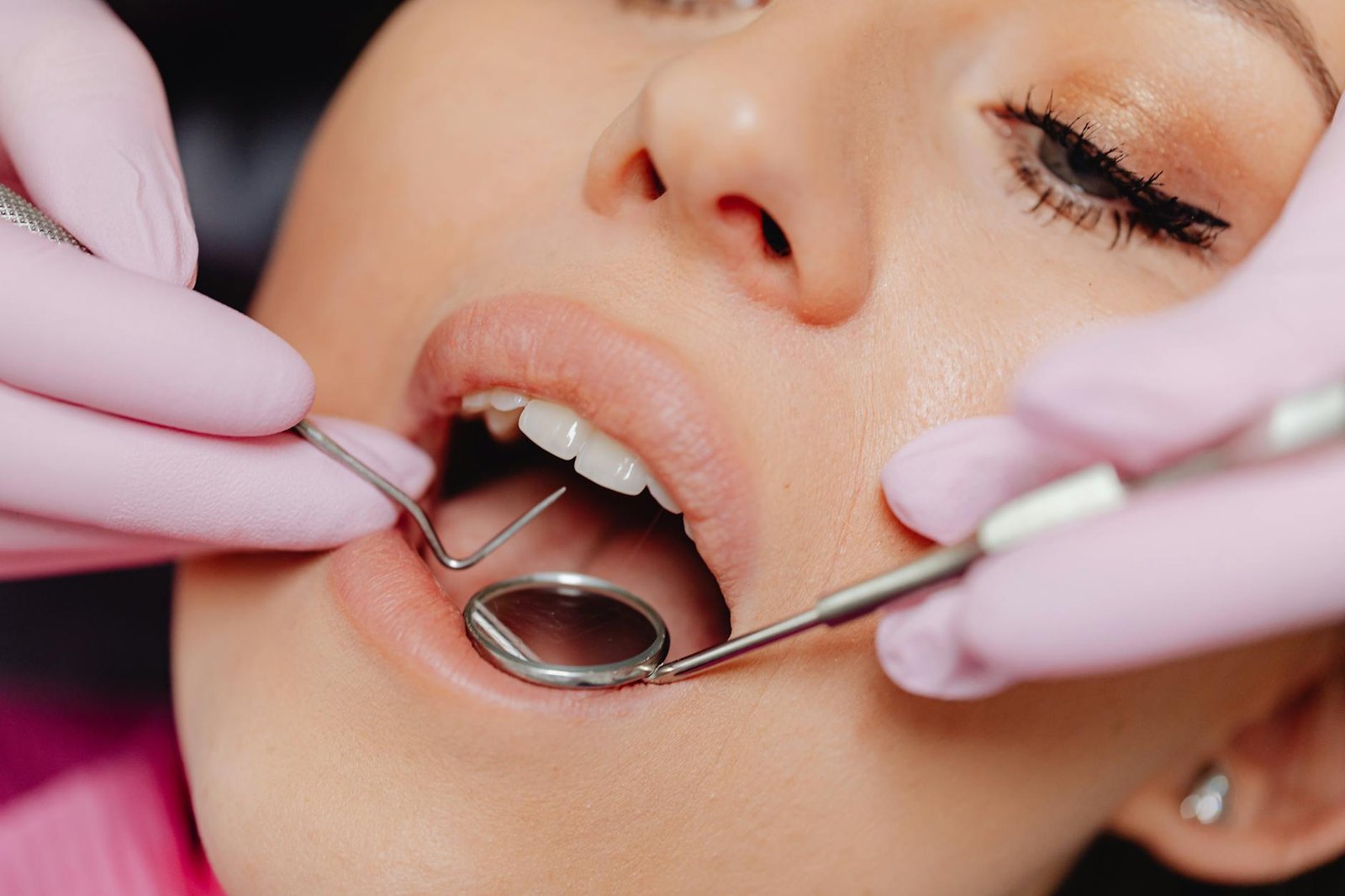 Illustration of Dry Mouth Treatment Hyderabad: Exclusive Xerostomia Care at Dentist N Dontist