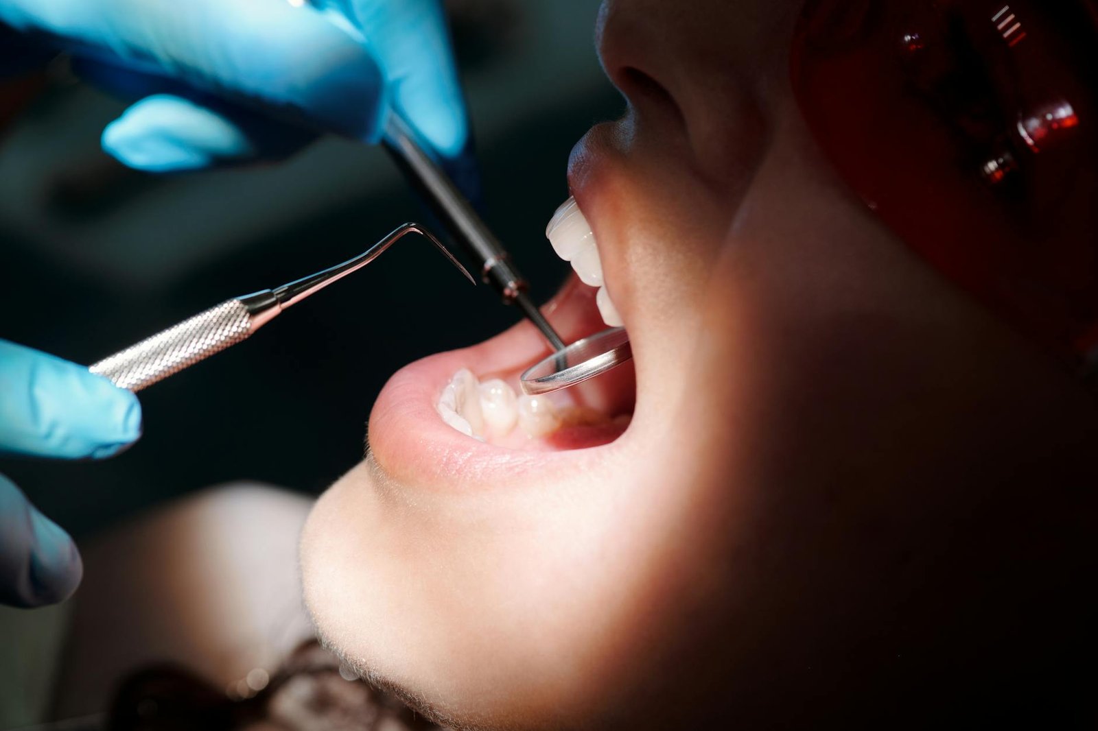 Illustration of Oral Cancer Screening: The Must-Have Affordable Dentist Near Jubilee Hills