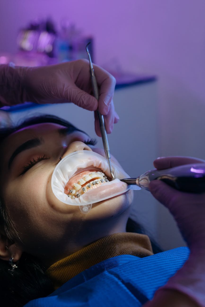 Dentist ‘N’ Dontist dental clinic near me Jubilee Hills Hyderabad illustration for Teeth Whitening in Jubilee Hills – Safe &