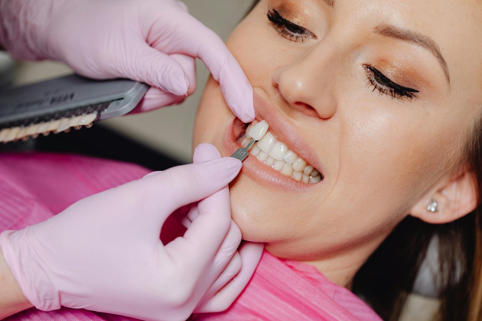 Illustration of Wedding Smile Makeover Hyderabad: Exclusive Dental Care for Grooms & Brides