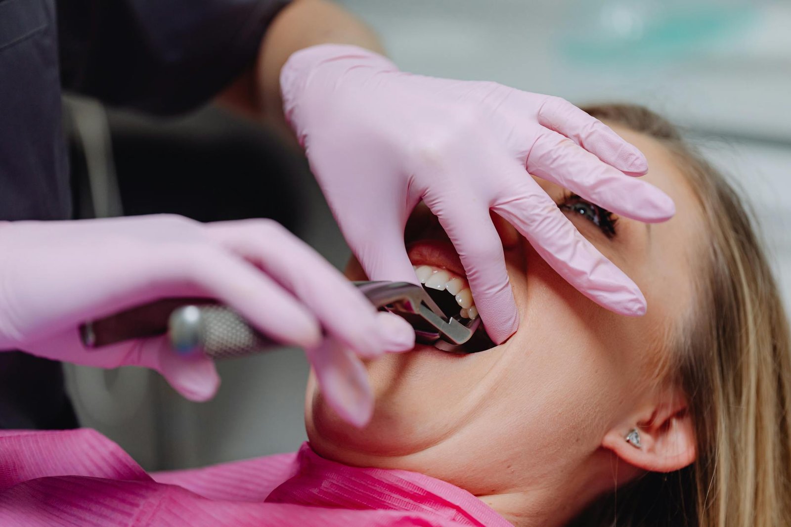 Illustration of Wisdom Tooth Removal Guide: Must-Have Tips from Best Dentist Near Jubilee Hills